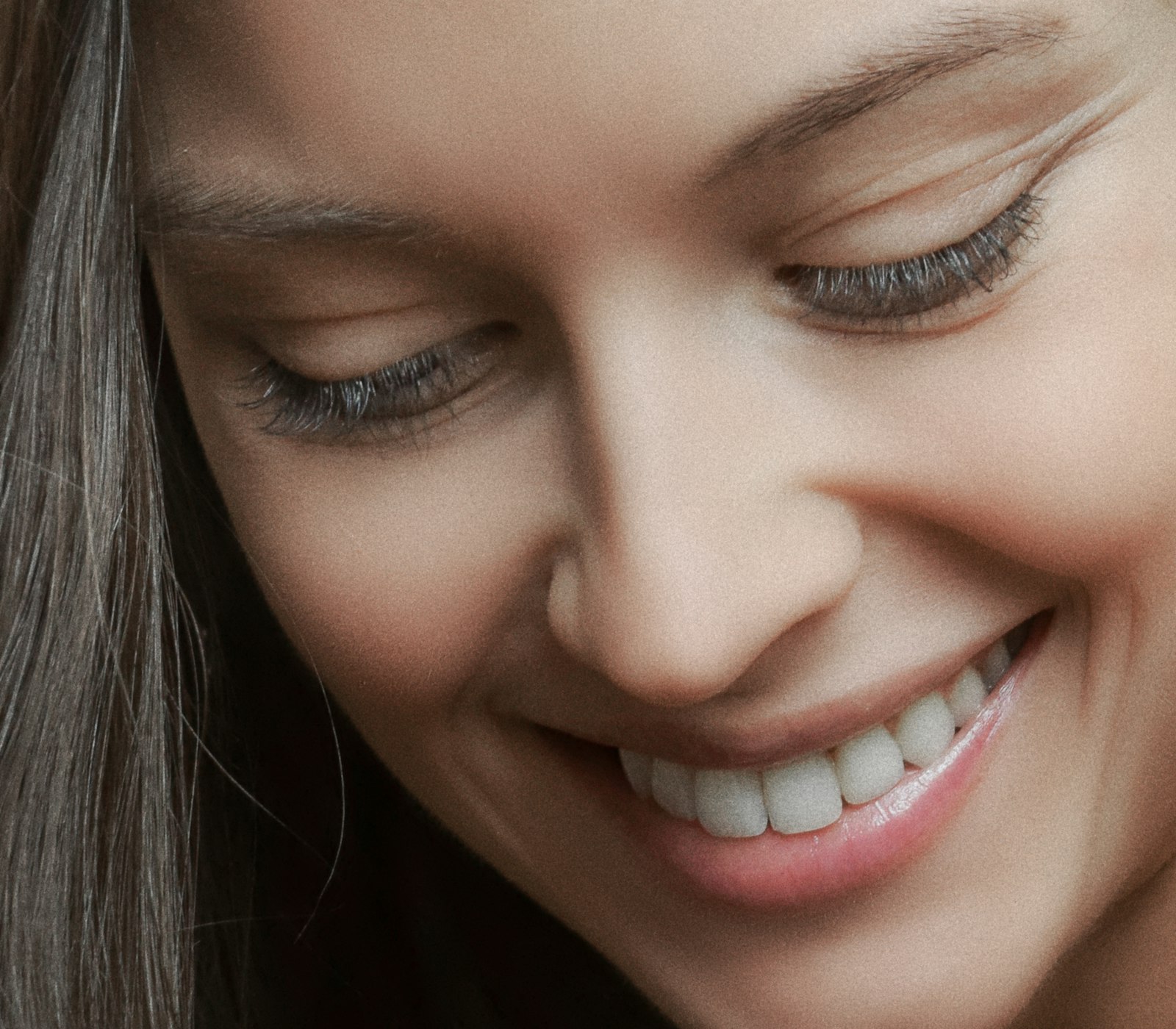 Smile after whitening