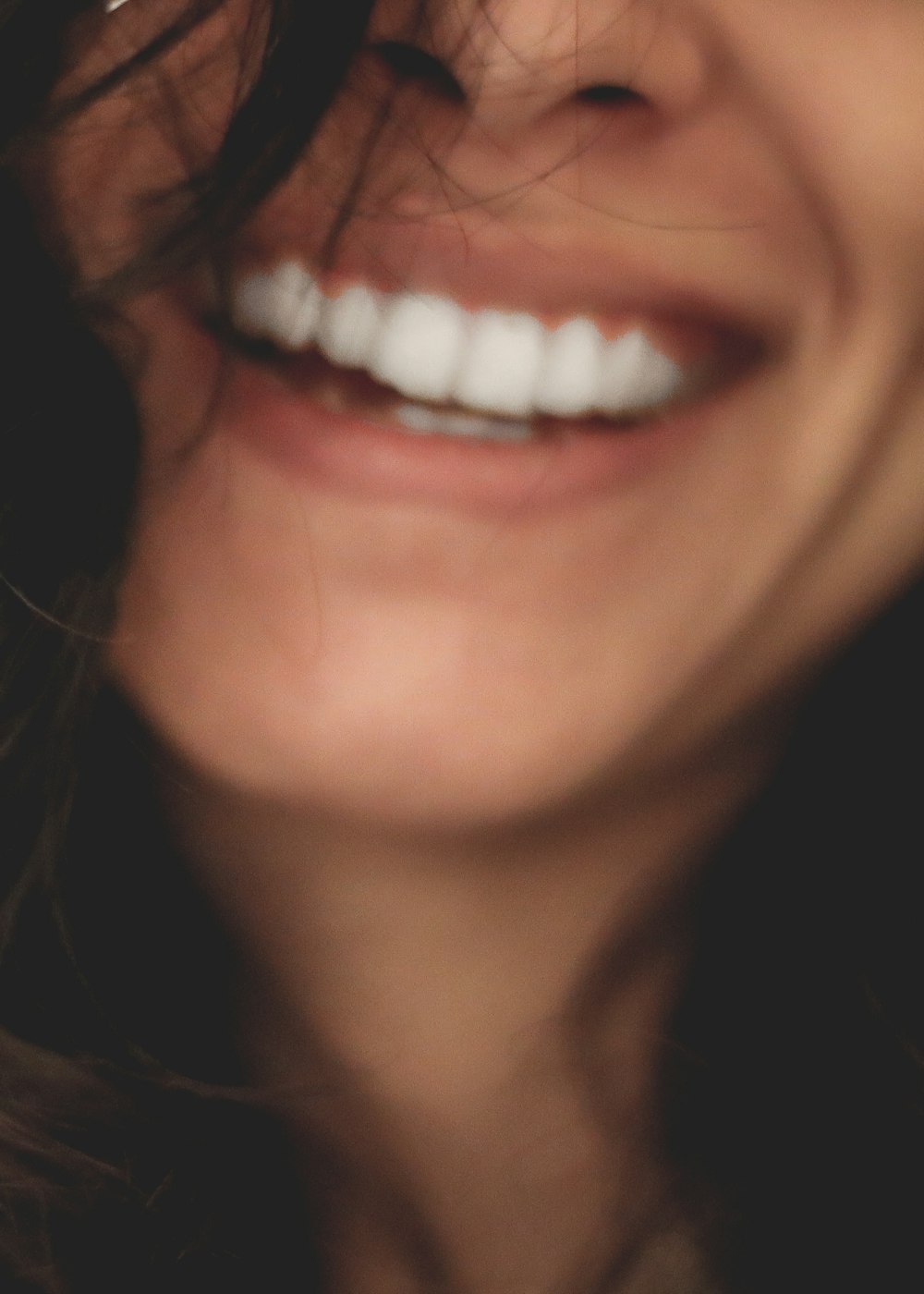 Patient smiling after treatment