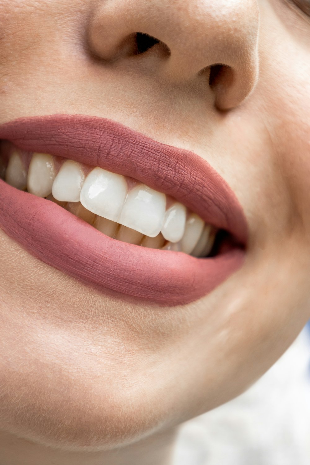 Teeth whitening
