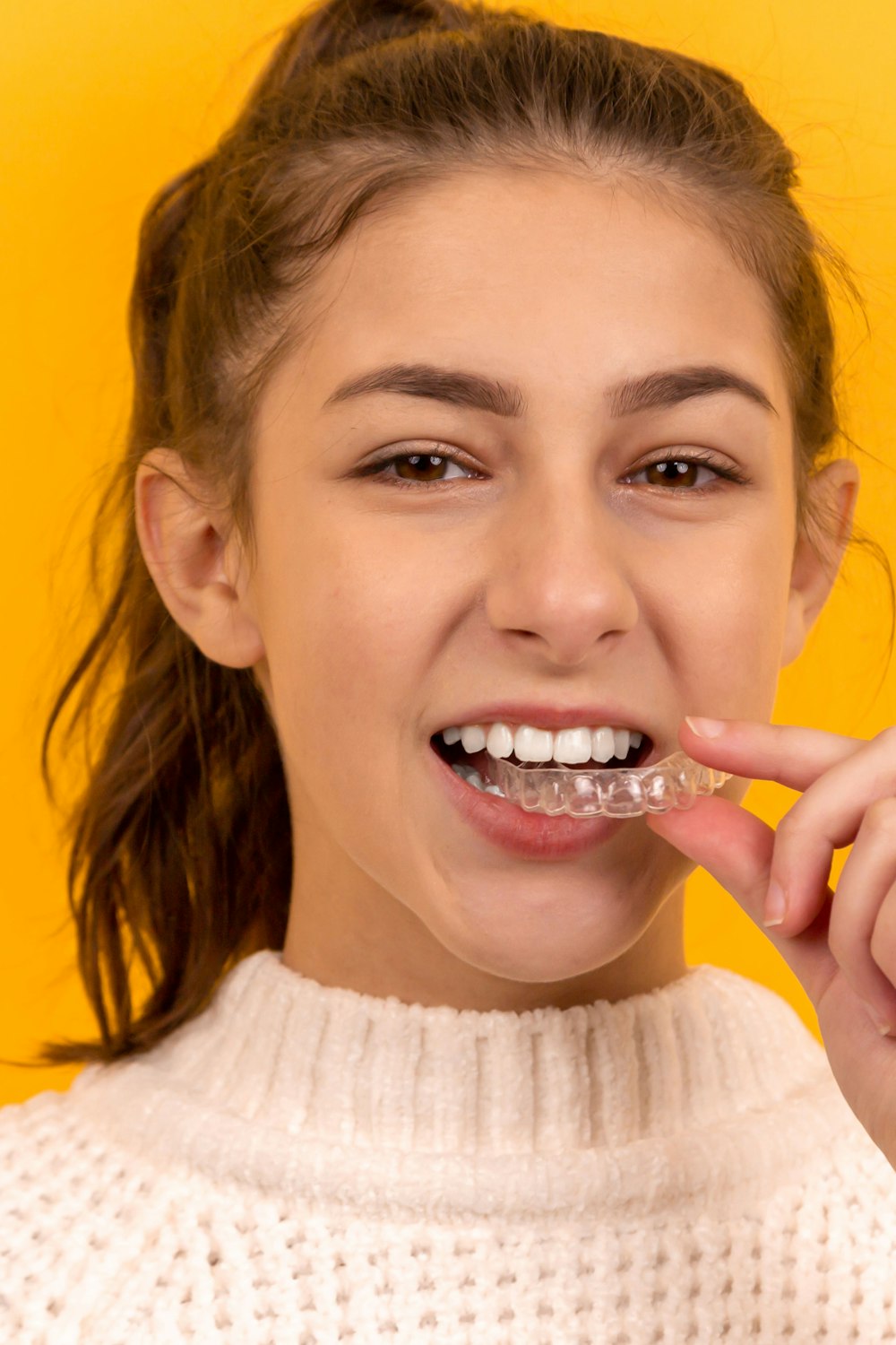 Clear aligners